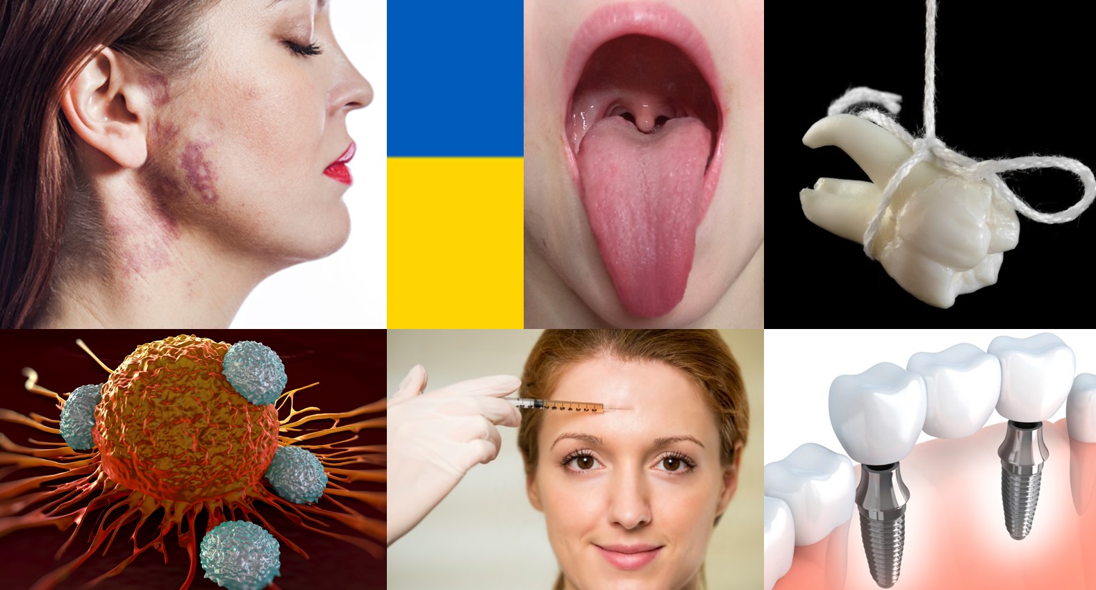 chir szczekowa ukrainski